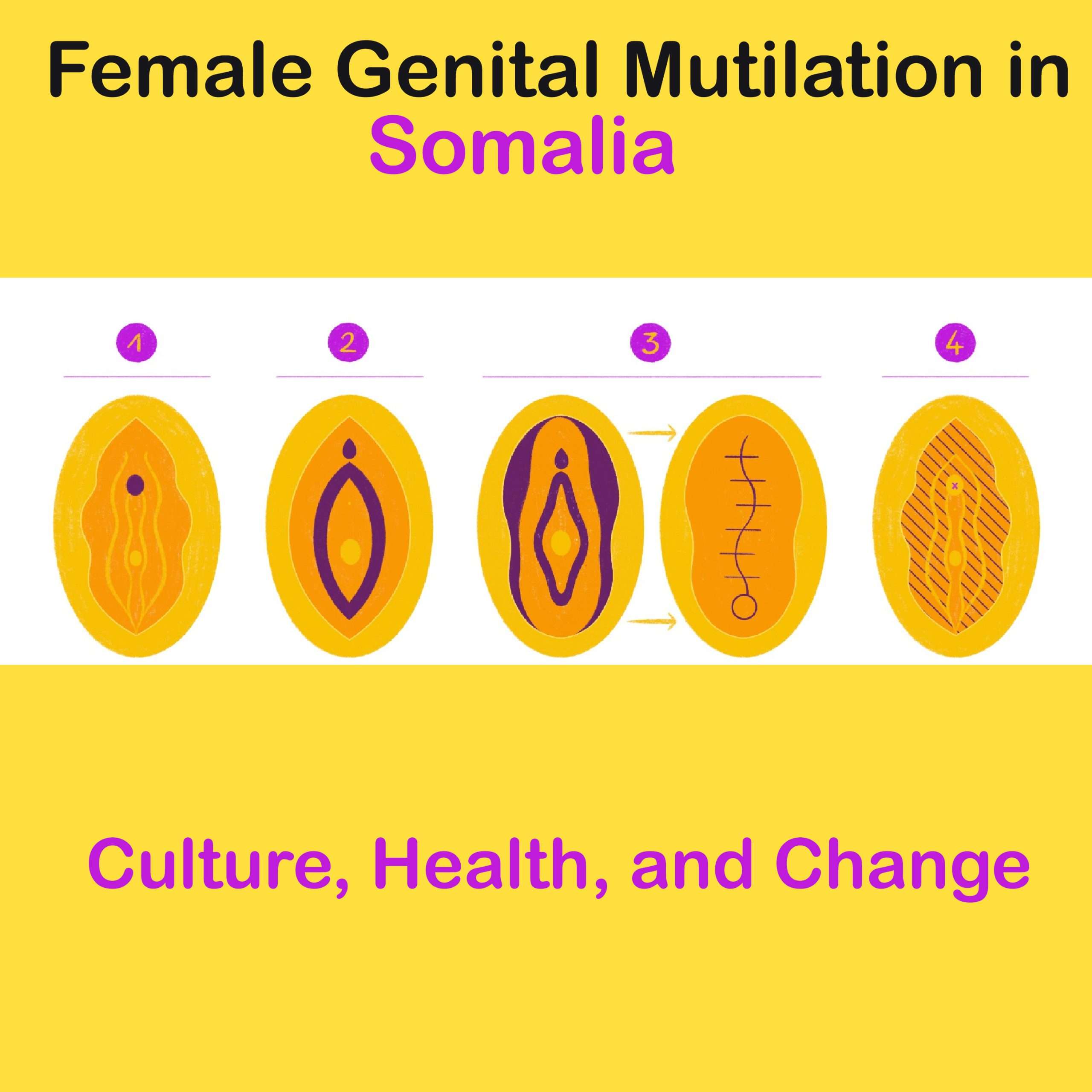 Female Genital Mutilation in Somalia